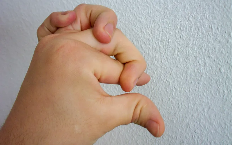 ND19_Ehlers-Danlos Syndrome2 ND19_Ehlers-Danlos Syndrome2