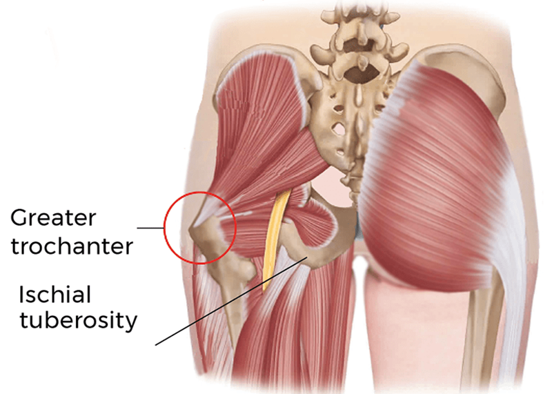 MJ21_DeepGlutealSyn1