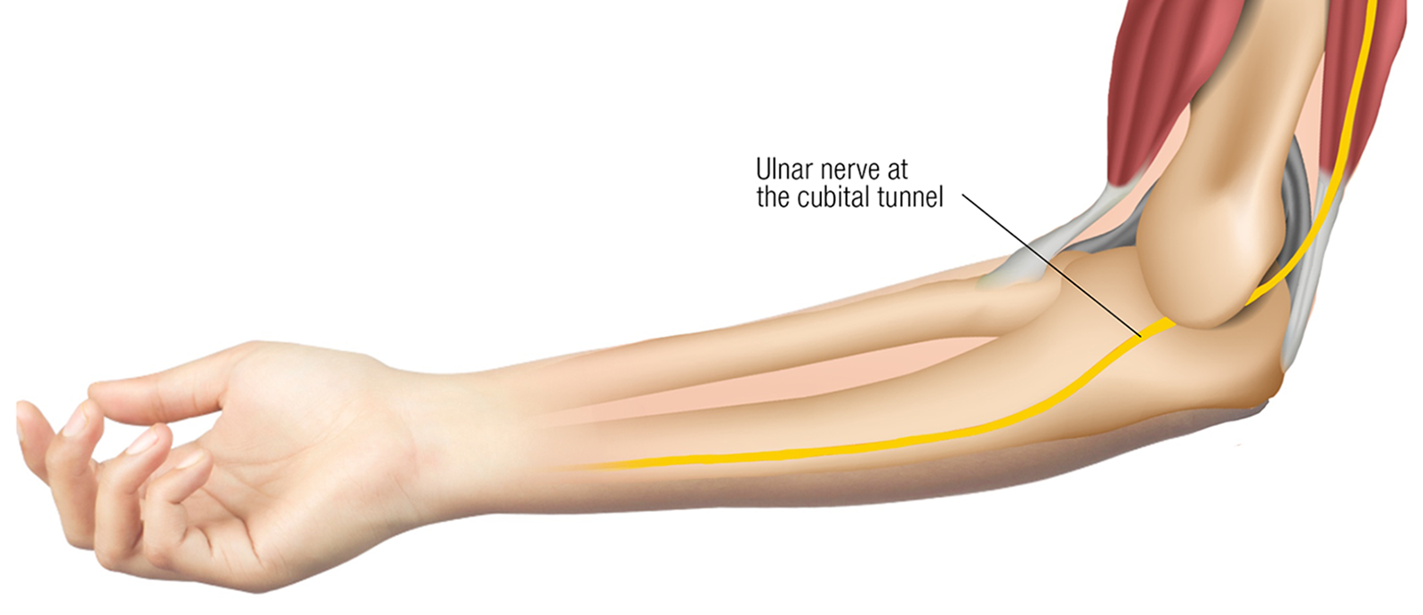MJ20_Endangerment Sites7 MJ20_Endangerment Sites7