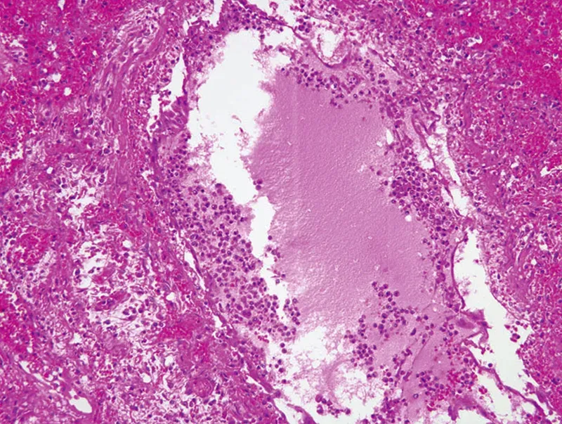 MJ20_Somatic Edge3 MJ20_Somatic Edge3