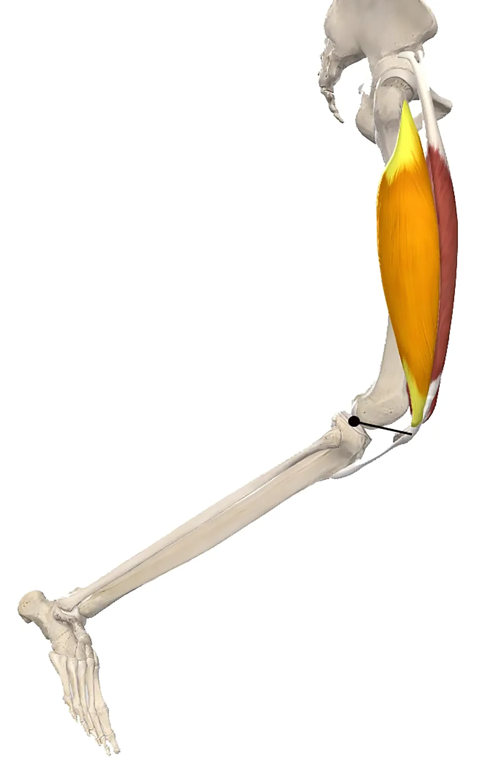 JA20_Grind Patellae1