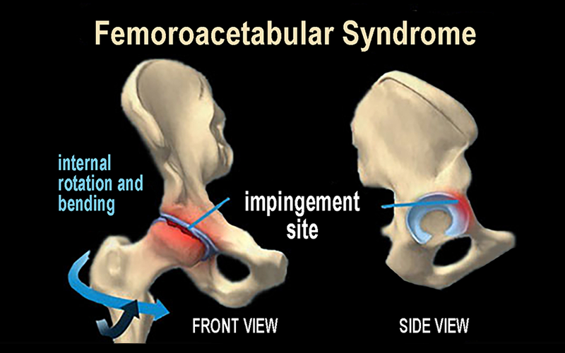 MJ_19_Myoskeletal2_800 MJ_19_Myoskeletal2_800