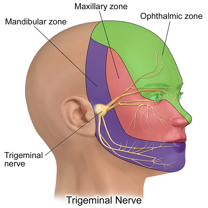 MA20_ Trigeminal Neuralgia