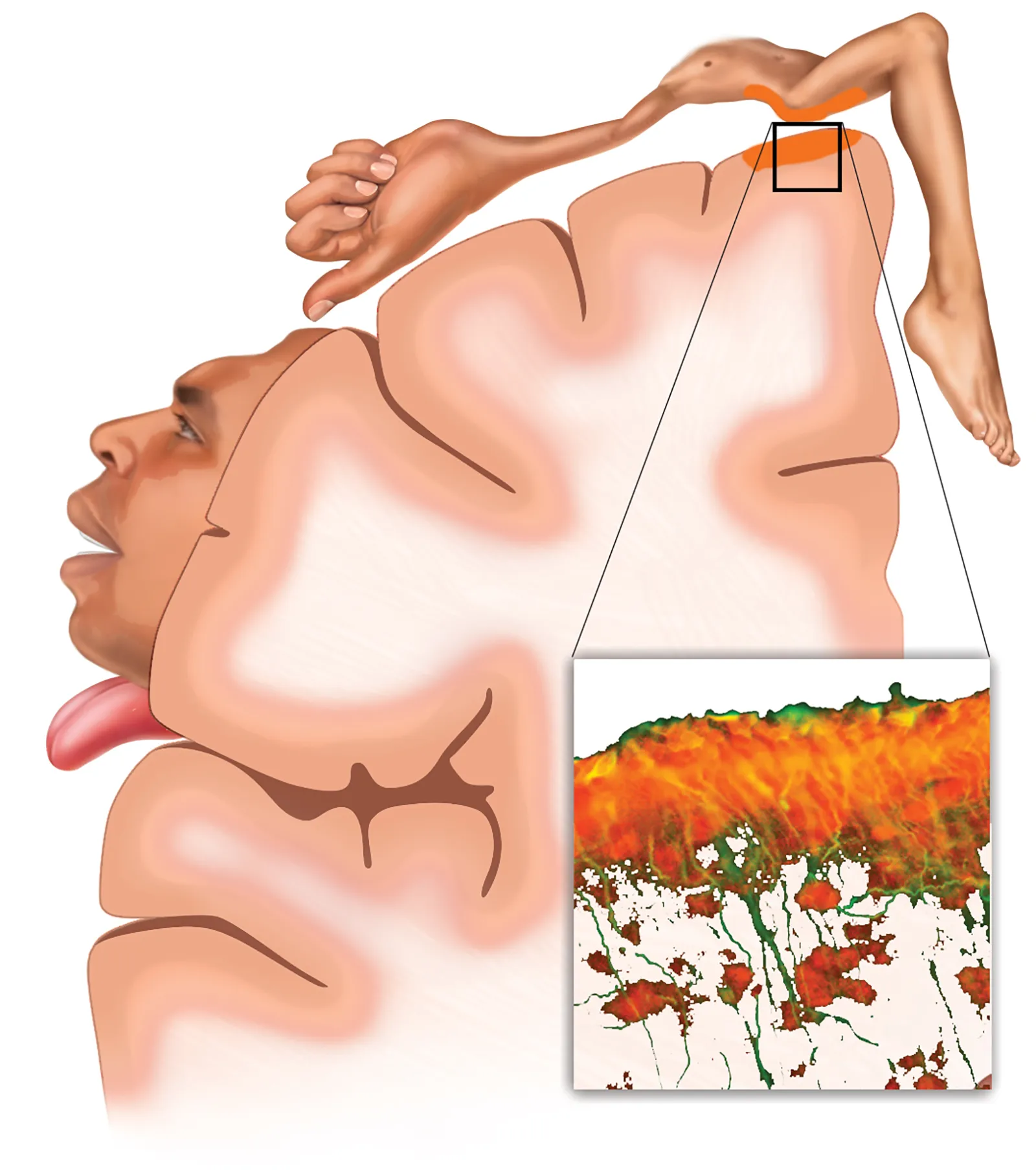 MA_19_SomaticEdge1_homunculus-glial-20181225_1600