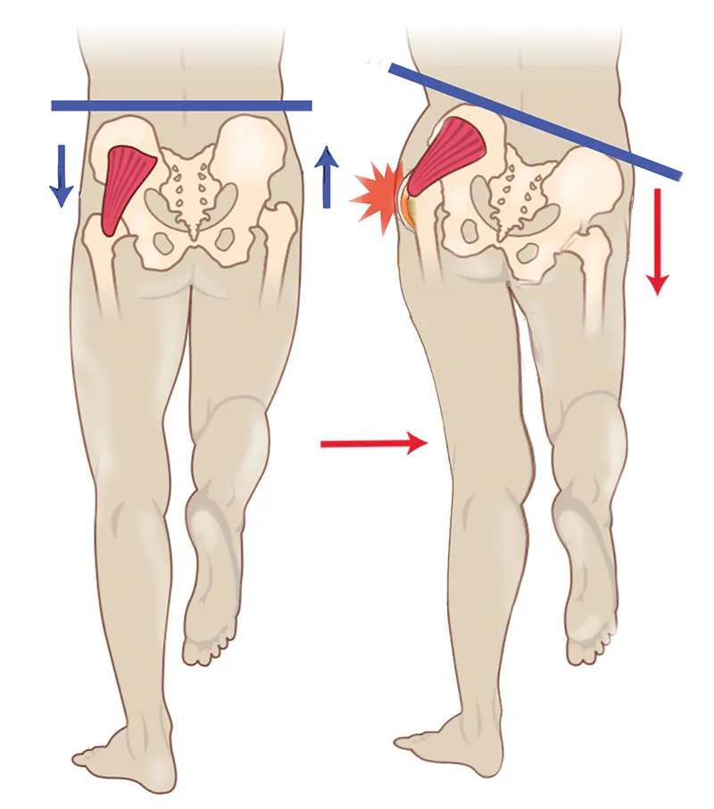 SO19_Healing the Hips4 SO19_Healing the Hips4
