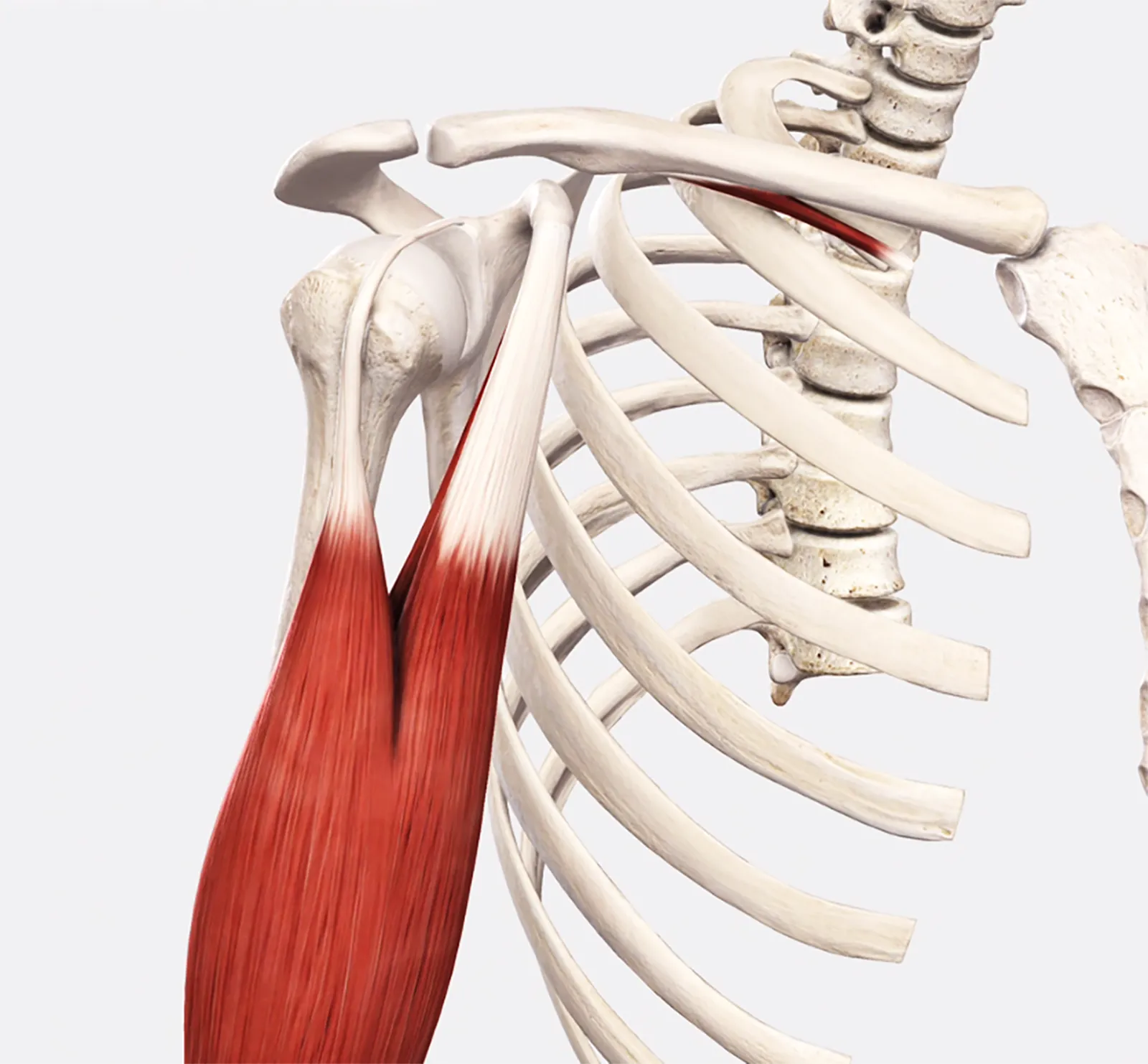 Bicipital Tendinopathy Teaser Image Bicipital Tendinopathy Teaser Image