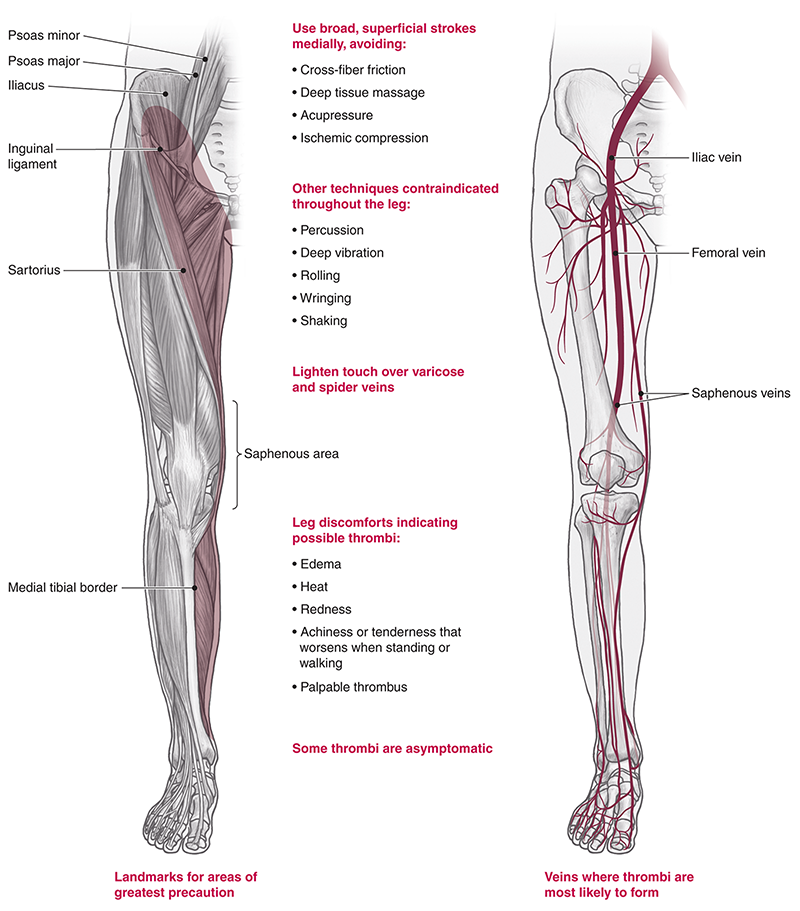 SO20_blood clot5 SO20_blood clot5
