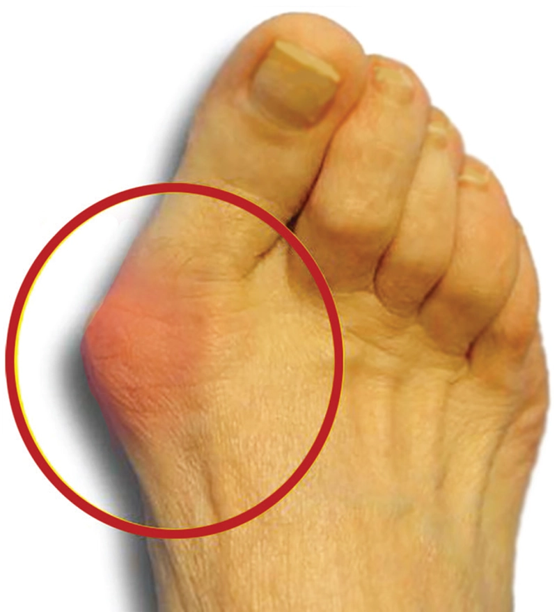 JF20_Myoskeletal3 JF20_Myoskeletal3