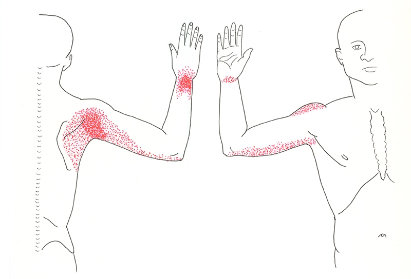 JF20_Slippery Subscap2