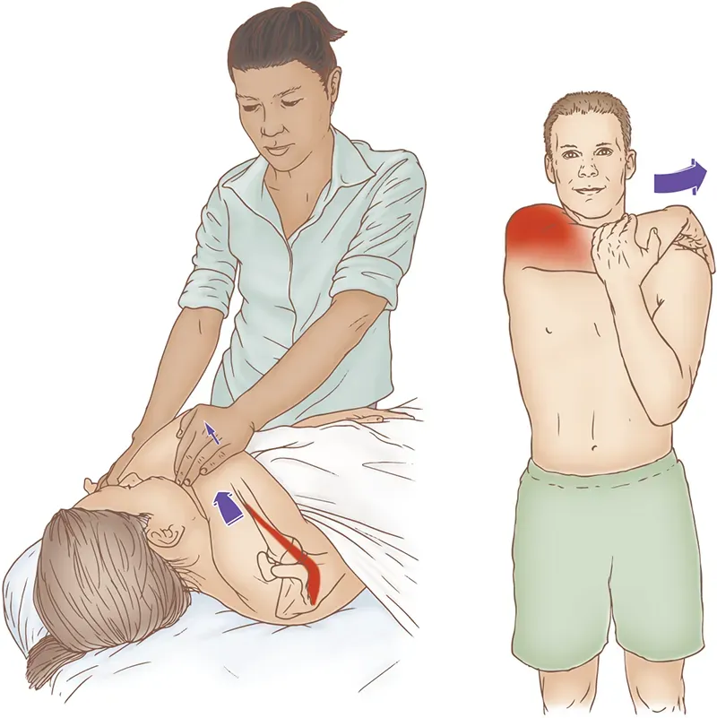 ND20_Combining Movement Therapies2 ND20_Combining Movement Therapies2