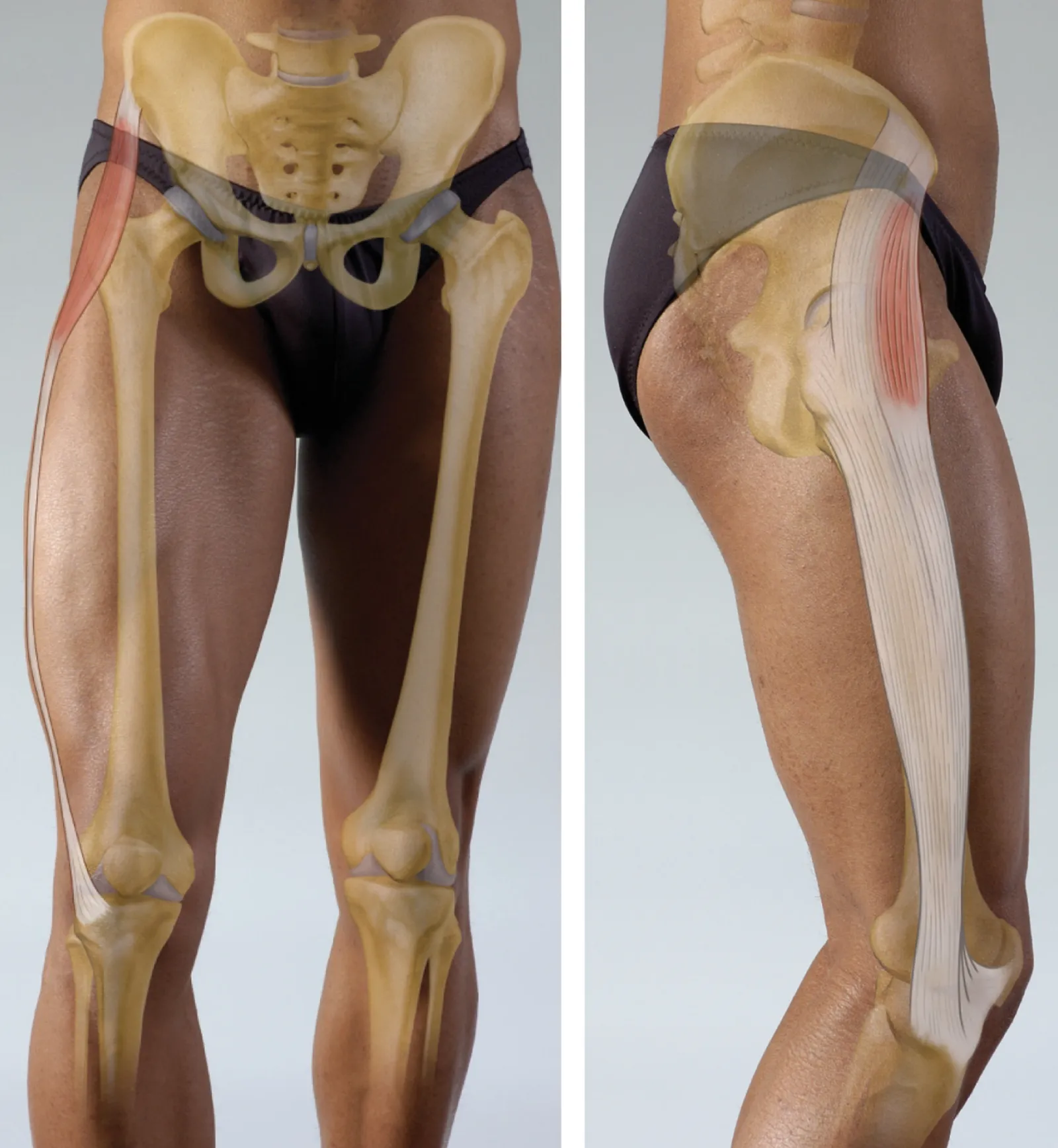 Tensor Fasciae Latae Teaser Image Tensor Fasciae Latae Teaser Image